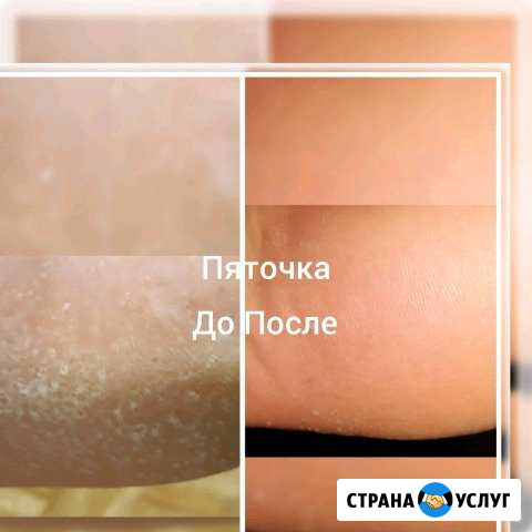 Педикюр Ханты-Мансийск - изображение 1