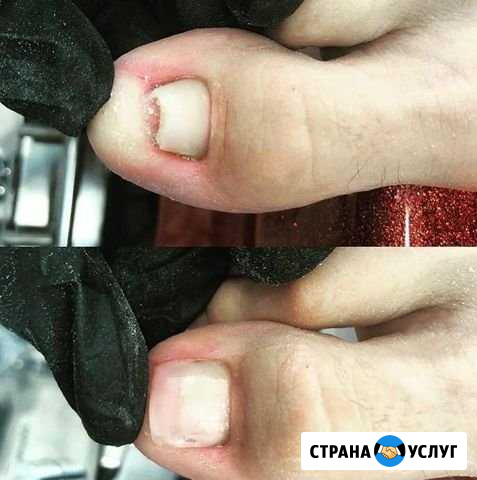 Наращивание ногтей Геленджик - изображение 1