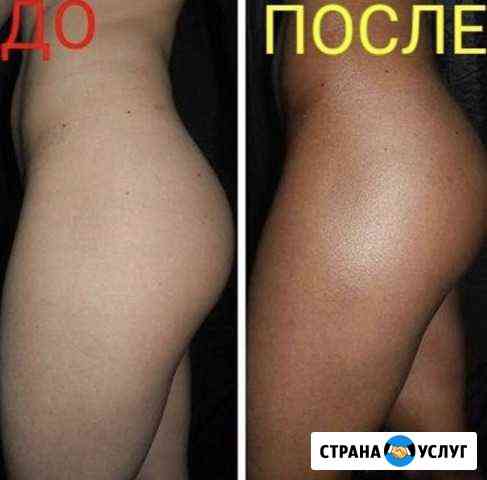 Моментальный загар, быстро,качественно,безопасно Братск