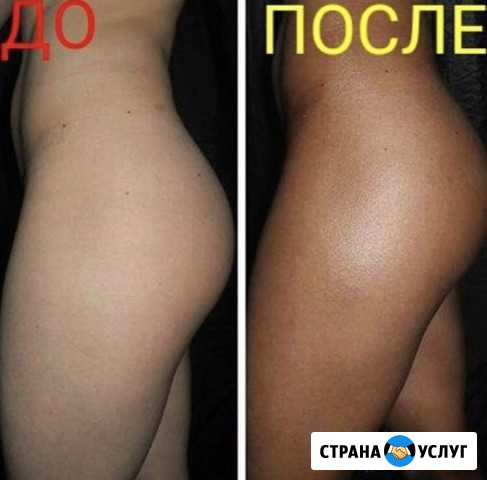 Моментальный загар, быстро,качественно,безопасно Братск - изображение 1