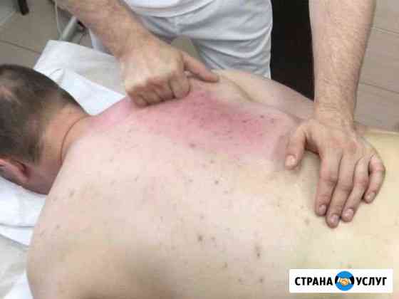 Миофасциальный массаж, миопрессура Волгоград