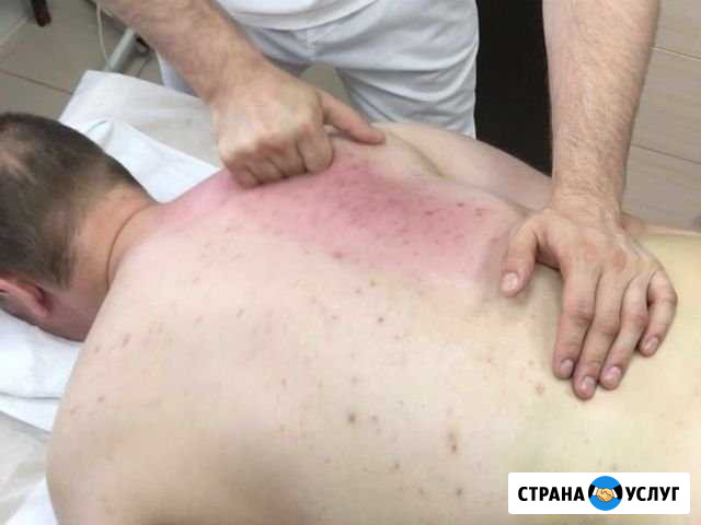Миофасциальный массаж, миопрессура Волгоград - изображение 1