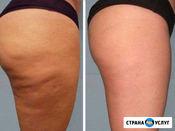 Массажный комплекс (модель) Белгород - изображение 1