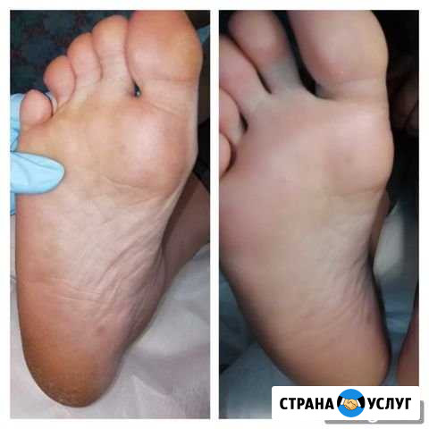 Педикюр Усть-Кут - изображение 1