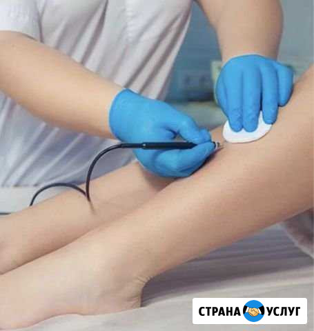 Обучение электроэпиляции Ростов-на-Дону - изображение 1