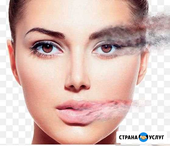 Удаление татуажа / татуировок Уфа - изображение 1