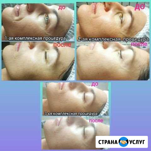 Уход за лицом и телом Благовещенск - изображение 1