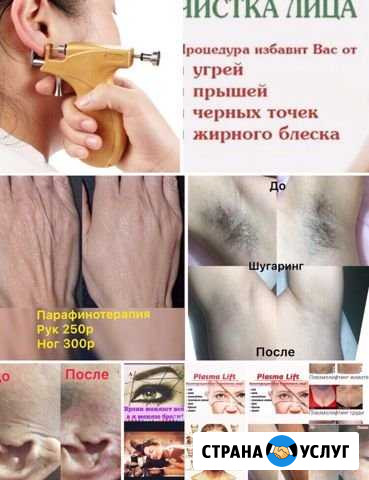 Массаж общий Элиста - изображение 1