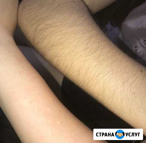 Предлагаю услуги по депиляции Братск - изображение 1