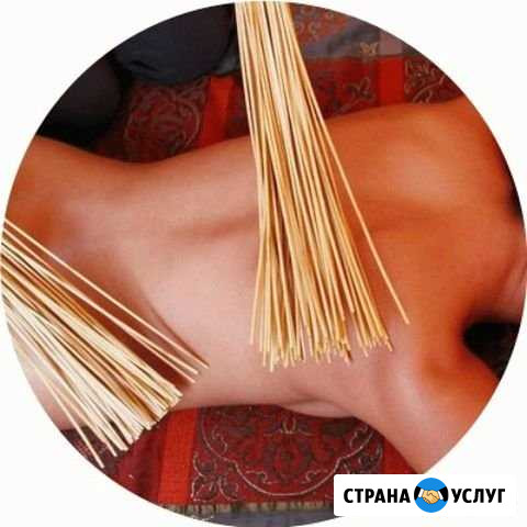 Коррекция фигуры Барнаул - изображение 1