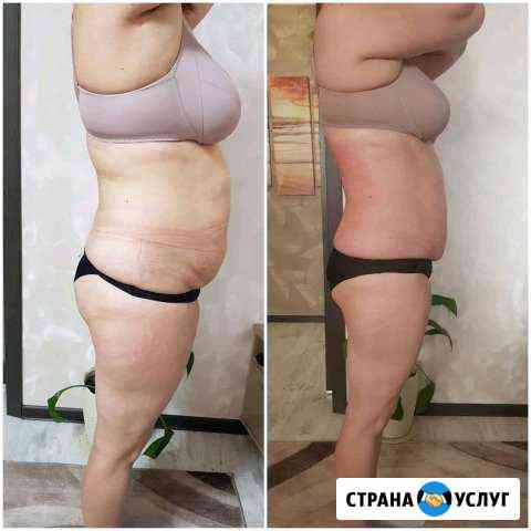 Аппаратный массаж Барнаул