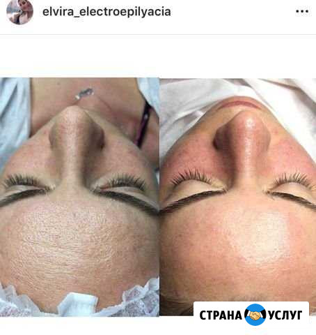 Косметологические услуги Шахты - изображение 1