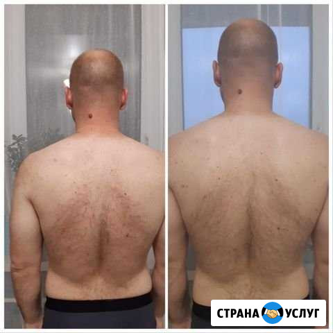 Массаж на выезд Мурино - изображение 1