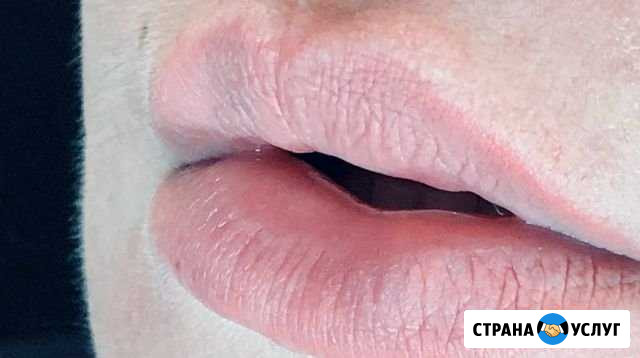 Удаление пм Балашиха - изображение 1