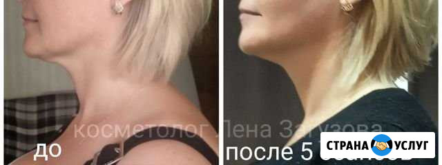Косметолог-эстетист, специалист Витапластики Калининград - изображение 1
