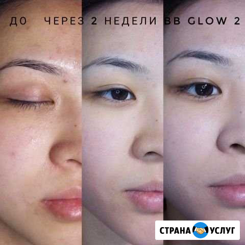 Эффект тонального крема Ижевск - изображение 1