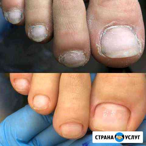 Аппаратный педикюр и маникюр Каменск-Уральский