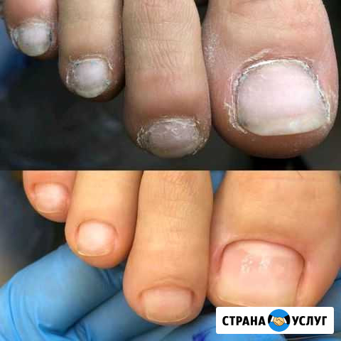 Аппаратный педикюр и маникюр Каменск-Уральский - изображение 1