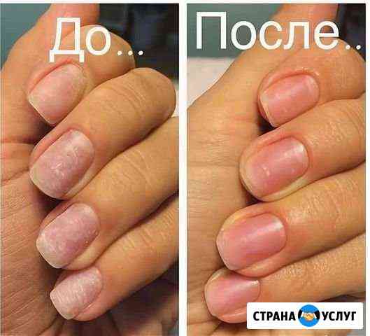 Маникюр, восстановление ногтей после наращивания и Ачинск