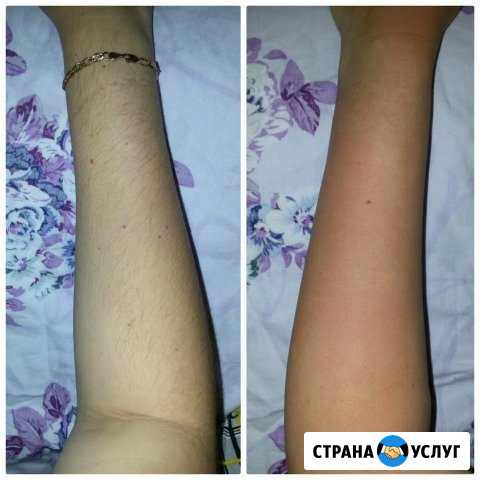 Воск, Шугаринг (сахарная депиляция ) мужской и жен Нижнекамск - изображение 1