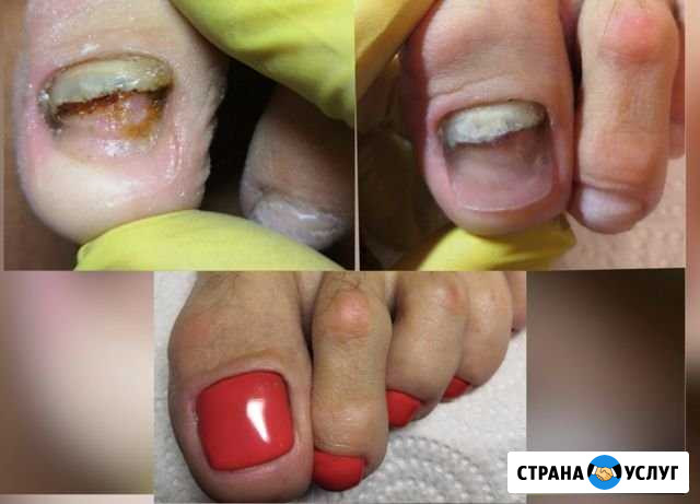 Педикюр, маникюр, выезд на дом Москва - изображение 1