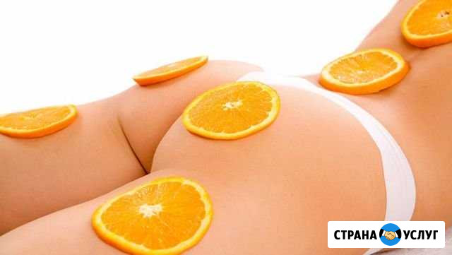 RF- лифтинг Красноярск - изображение 1