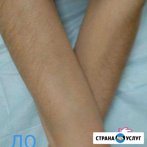 Шугаринг Депиляция Улан-Удэ - изображение 1
