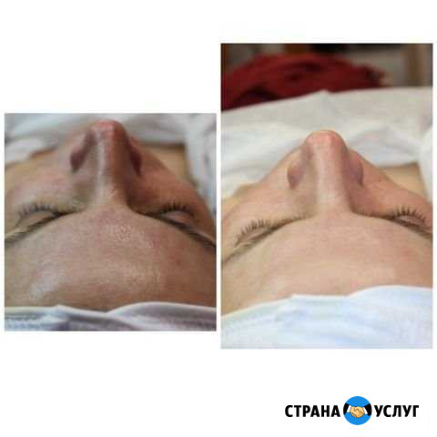 Услуги косметолога Норильск - изображение 1