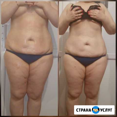 Массажные услуги Рубцовск - изображение 1