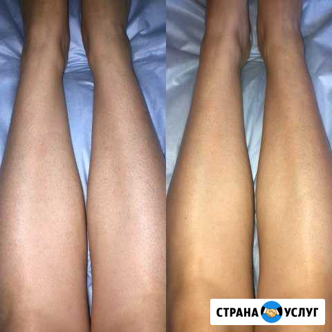 Шугаринг Омск - изображение 1