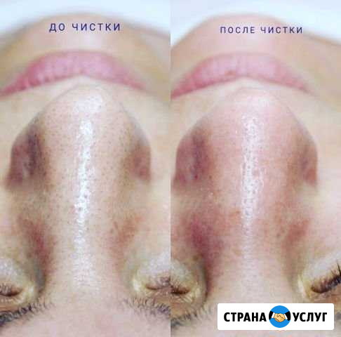 Косметолог с мед образованием Гусев - изображение 1