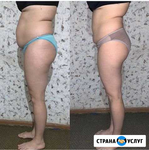 Антицеллюлитный массаж Астрахань - изображение 1
