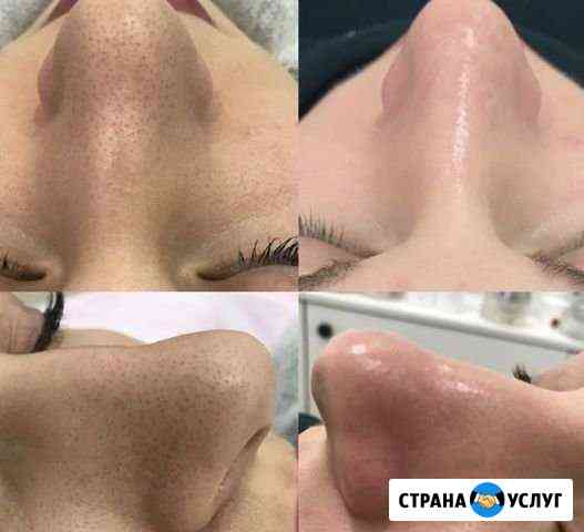 Косметолог микротоки, Чистку лица ультразвук, меха Красногорск