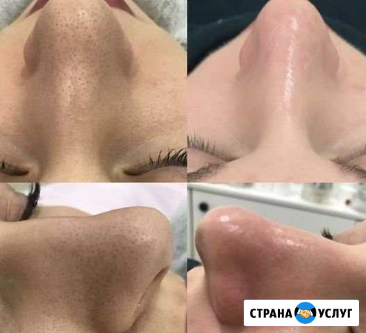 Косметолог микротоки, Чистку лица ультразвук, меха Красногорск - изображение 1