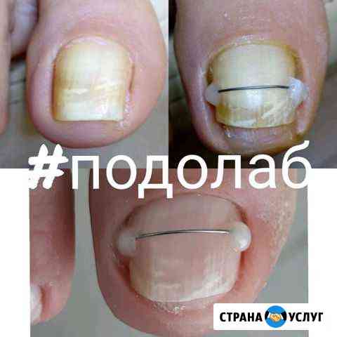 Аппаратный уход за стопой,SPA педикюр Обнинск