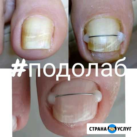 Аппаратный уход за стопой,SPA педикюр Обнинск - изображение 1