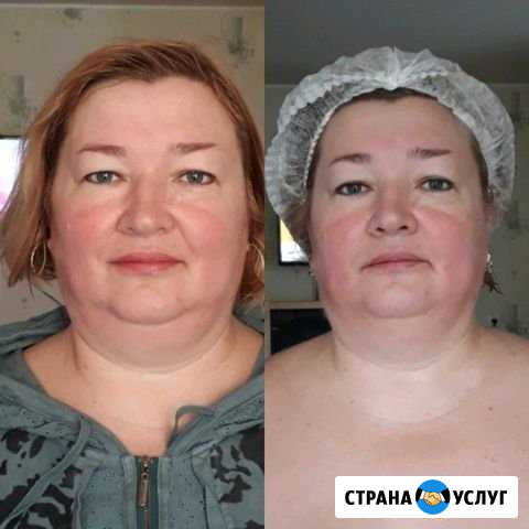 Массаж Новочеркасск - изображение 1
