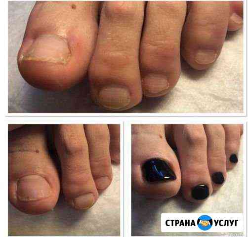 Педикюр Санкт-Петербург