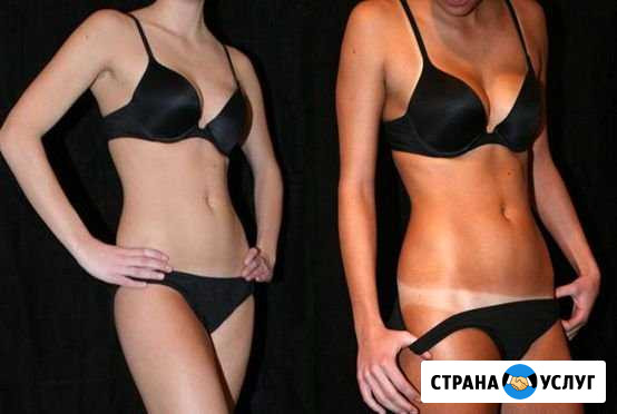 Кабинет лазерной эпиляции Анапа - изображение 1