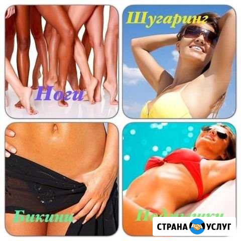 Шугаринг Череповец - изображение 1