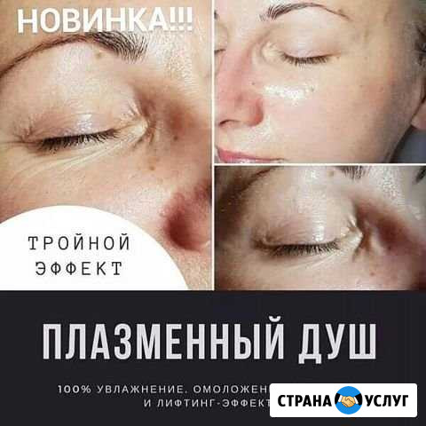 Плазменное омоложение Ижевск - изображение 1