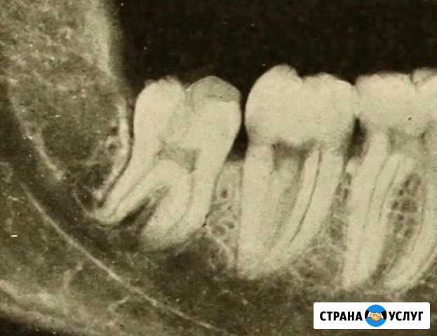 Радиационно-гигиенический паспорт (стоматология) Тверь - изображение 1