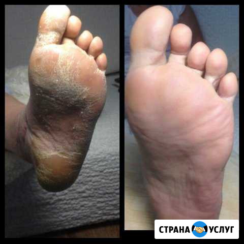 Мастер маникюра и педикюра на дому Барнаул - изображение 1