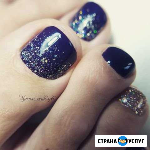 Педикюр Мурино - изображение 1