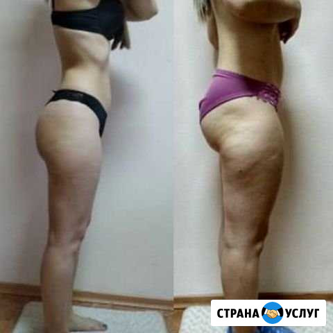 Професиональный массаж Йошкар-Ола - изображение 1