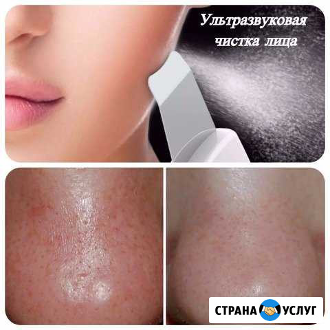 Ультразвуковая чистка лица Георгиевск - изображение 1