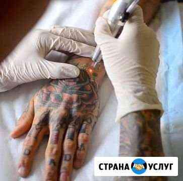 Удаление татуировок и татуажа бровей Тула
