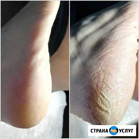 Педикюр,гель лак Великие Луки - изображение 1