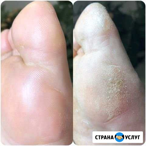 Педикюр Новомосковск - изображение 1