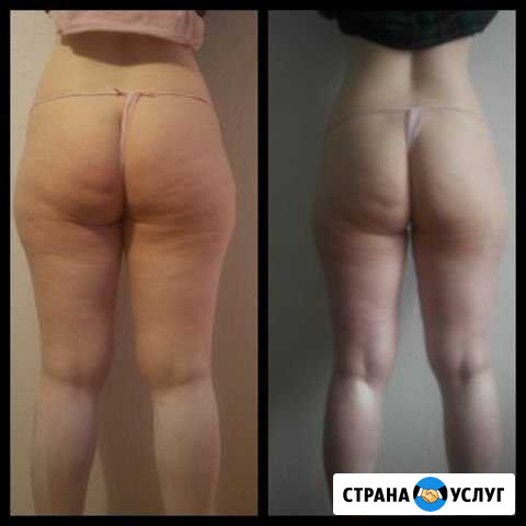 Скульптурный массаж для женщин Санкт-Петербург - изображение 1